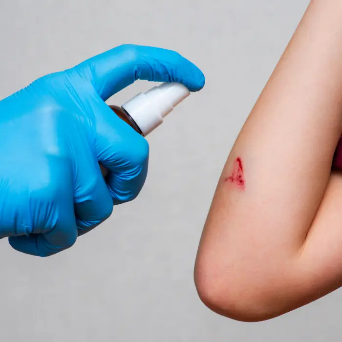 antiséptico en brazo herido